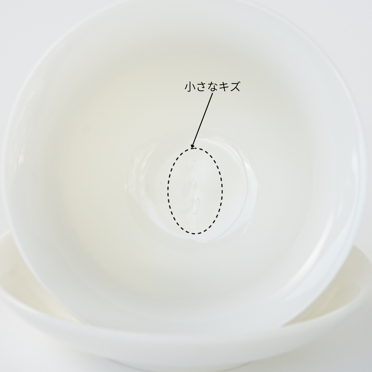 拡大